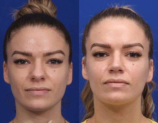 Facial Plastic Surgery