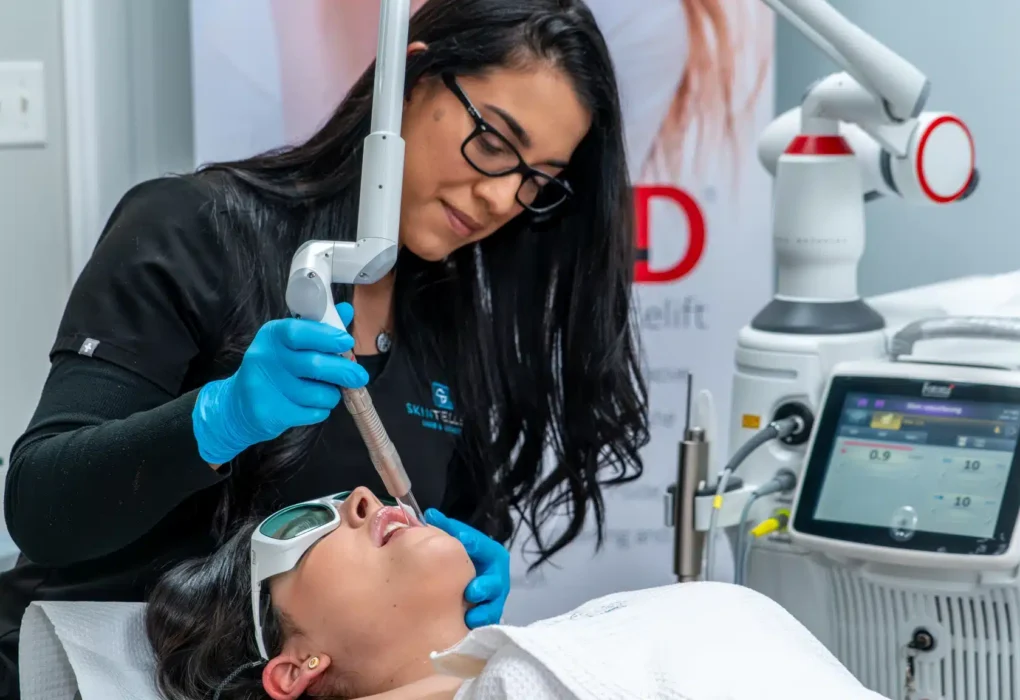 Fotona 4D: The Non-Surgical Lift Everyone Is Talking About
